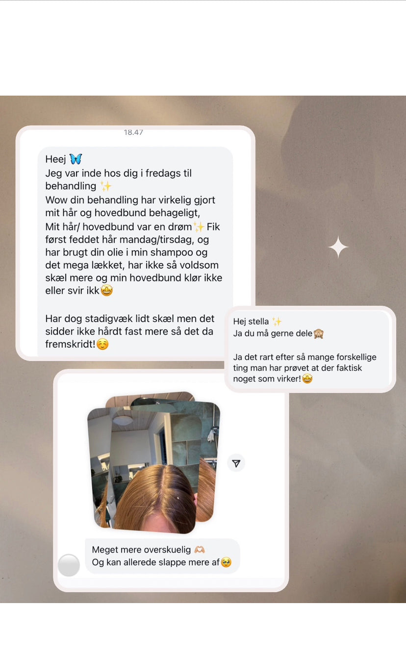 Afhjælp og bekæmp psoriasis hos prettycute head and hair spa